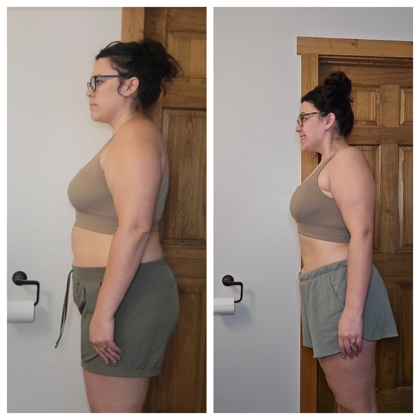 Client before and after side profile transformation